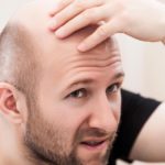 łysienie przez koronawirusa