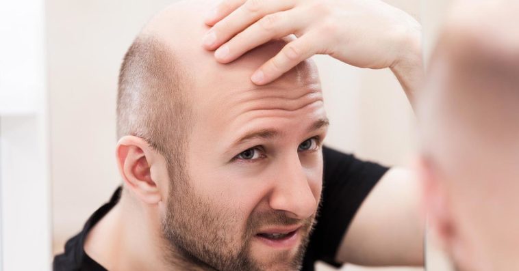 łysienie przez koronawirusa