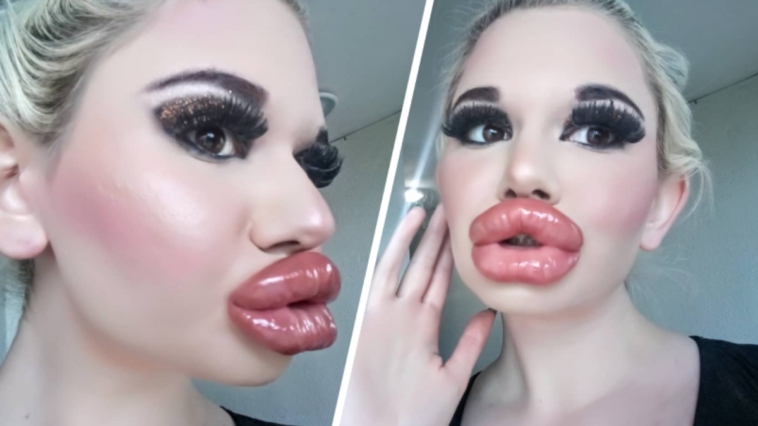 andrea ivanova instagram usta biust operacje plastyczne przed operacją