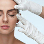 blefaroplastyka powiek opinie cena przed i po efekty cena