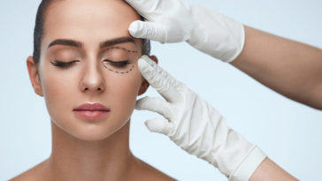 blefaroplastyka powiek opinie cena przed i po efekty cena