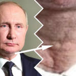 stan zdrowia putina parkinson rak tarczycy