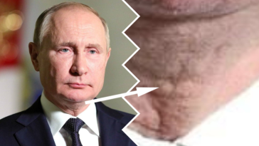 stan zdrowia putina parkinson rak tarczycy