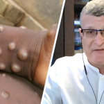 małpia ospa w polsce