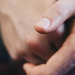 czerniak podpaznokciowy rokowania leczenie objawy