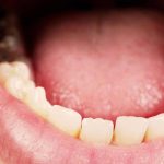 od czego psują się zęby u dzieci