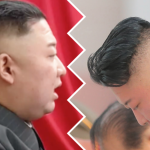 kim dzong un choroba