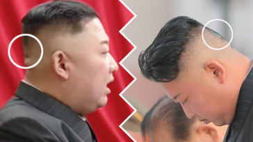 kim dzong un choroba