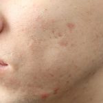 dermatolog prywatnie