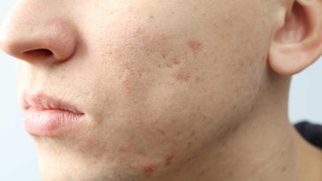 dermatolog prywatnie