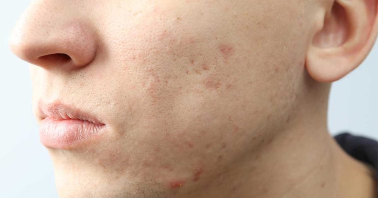 dermatolog prywatnie