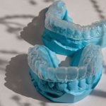 nakładki ortodontyczne cena opinie