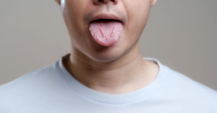 candida auris w polsce objawy