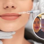 powiększanie ust czy jest bezpieczne