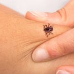 co przyciąga kleszcze