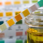 kolor moczu co oznacza