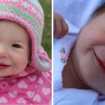 zespół williamsa długość życia