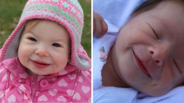 zespół williamsa długość życia