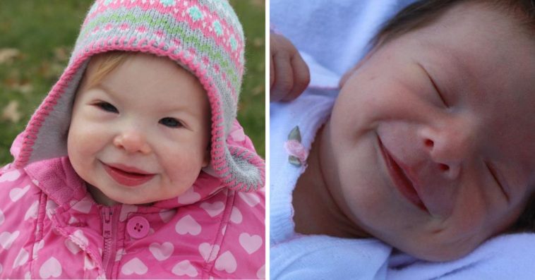 zespół williamsa długość życia