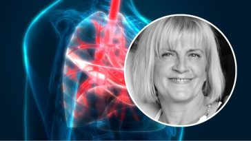 Marzena Kipiel-Sztuka choroba