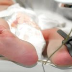 koszalin dziecko szpital