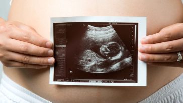 domowy test ciążowy z cukrem forum