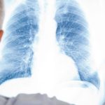 szczepionka na pneumokoki szczepienie