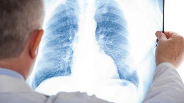 szczepionka na pneumokoki szczepienie