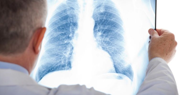 szczepionka na pneumokoki szczepienie