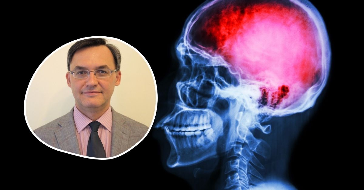Stan alarmowy w Polsce. Lekarze ostrzegają. Mamy epidemię udarów mózgu