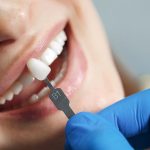 implanty zębów forum