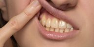 jak szybko wybielić żółte zęby