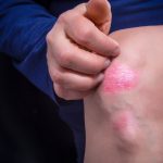 co oznacza jak swedzi kolano lewe prawe przesady