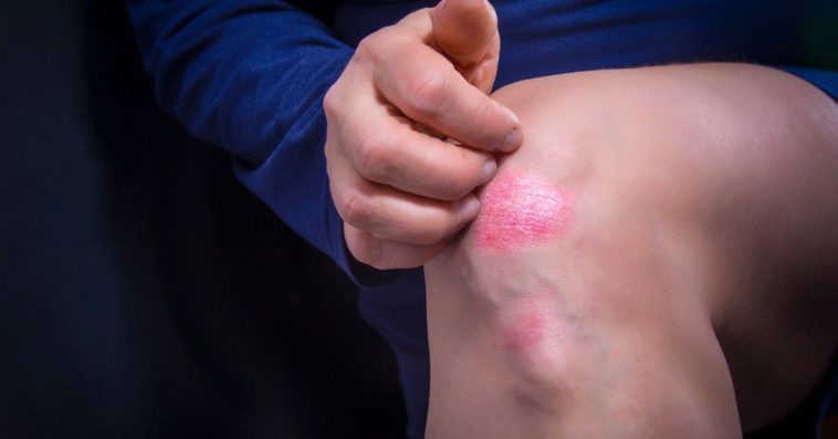 co oznacza jak swedzi kolano lewe prawe przesady