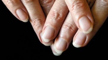 rak płuc wczesne objawy forum