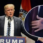 trump siniaki na rękach