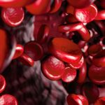 niski poziom ferrytyny objawy przyczyny żelazo w normie